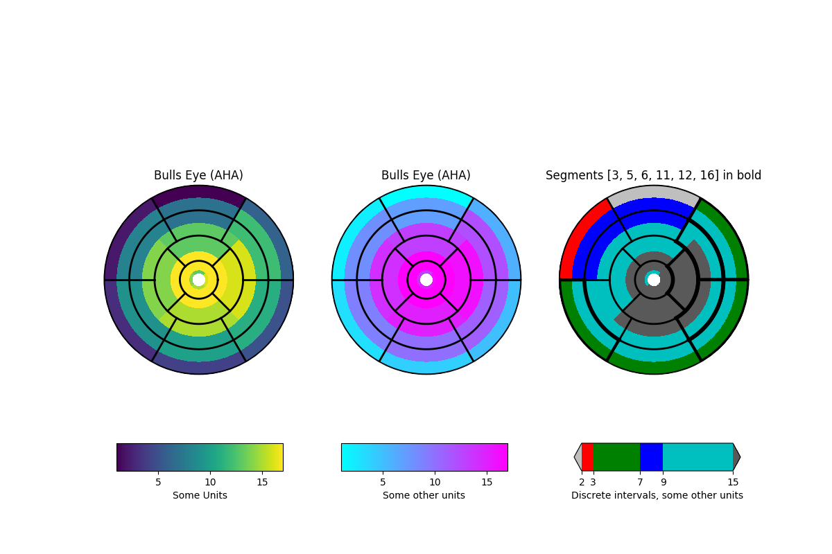 Bulls Eye (AHA)，Bulls Eye (AHA)，粗体部分 [3, 5, 6, 11, 12, 16]